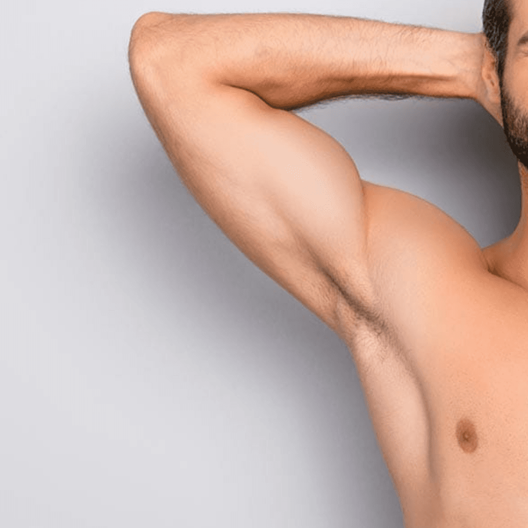 הסרת שיער בלייזר — גברים